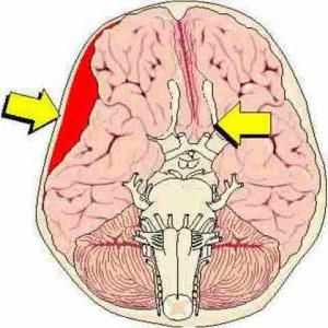 Kompresija mozga: vrste, simptomi, dijagnoza i liječenje