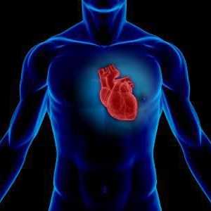 Srčani udar: uzroci, dijagnoza, liječenje