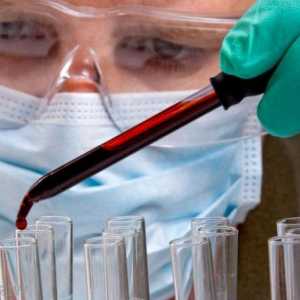 Serološki test krvi u dijagnozi bolesti