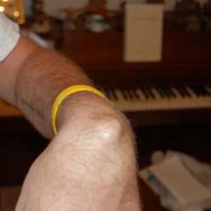 Čunovi na ruci na zglobu ili higrom: simptomi, uzroci i metode liječenja