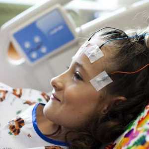 Simptomi epilepsije kod djeteta. Uzroci, dijagnoza, liječenje