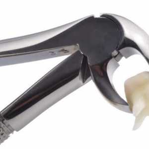 Koliko se edem čuva nakon uklanjanja zuba: razloge pojave i značajki liječenja