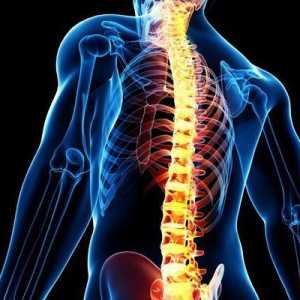 Spinalni šok: razvojni mehanizmi, simptomi i karakteristike liječenja