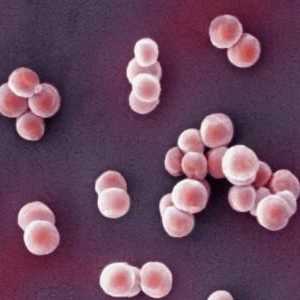 Staphylococcus: što je to i koliko je opasno?