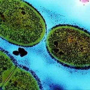 Streptococcus - što je to? Vrste streptokoka