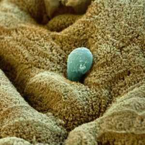 Struktura i životni ciklus dizente ameba