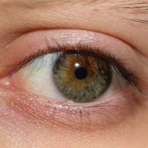 Suhe oči: uzroci i liječenje narodnih lijekova i kapi