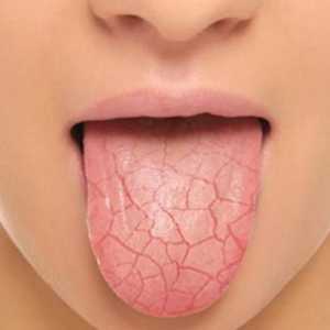 Suha usta: uzroci i uklanjanje