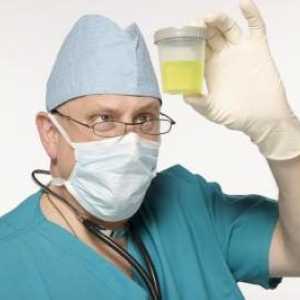 Dnevna diureza, ili Kako prikupiti dnevni urin