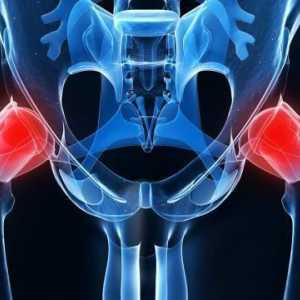 Hip joint, X-ray: značajke postupka, prednosti i nedostatke