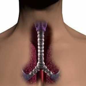Traheitis: simptomi akutne i kronične upale dušnika