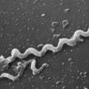 Treponema pallidum (Treponema pallidum) - uzročnik sifilisa