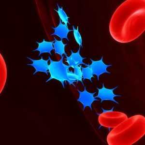 Trombocitopenija - što je to? Uzroci i simptomi bolesti
