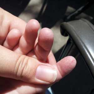 Kod djeteta koža na prstima prstiju će shvatiti, što učiniti ili napraviti?
