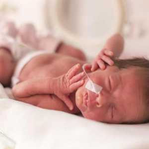 Briga za prerane bebe u bolnici i nakon izbijanja