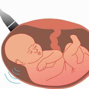 Proučavanje ultrazvučnih pregleda. Test probiranja za trudnoću
