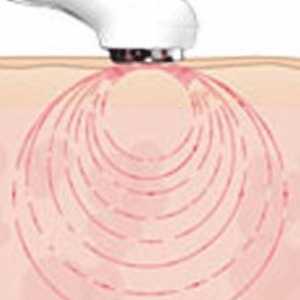 Ultrazvučna fonoforeza za kućnu uporabu