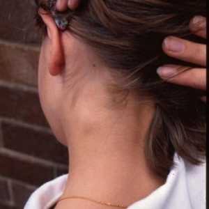 Limfni čvor na vratu djece povećava se. Što kažete?