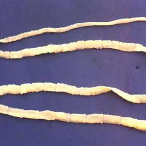 Kakva je sličnost ravnih i okruglih crva? Usporedne značajke ravnih i okruglih crva
