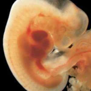 Intrauterni razvoj djeteta: razdoblja i faze s fotografijom. Intrauterin razvoj djeteta po mjesecu