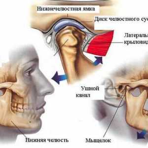 Upala čeljusnog zgloba: uzroci i liječenje