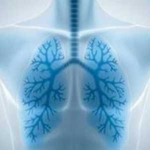 Upala pluća: simptomi (bez temperature). Koji su simptomi upale pluća?