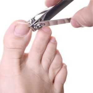 Uzgoj noktiju na nogama: uzroci i metode liječenja