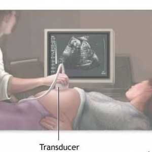 Drugi ultrazvuk u trudnoći u koje vrijeme? Ultrazvuk u trudnoći: kada i koliko puta