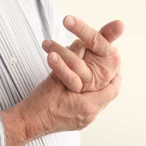 Dislokacija prsta na ruci: opis i značajke liječenja