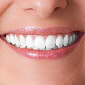 Dentalni implantati: pro i kontra. Dentalni implantati: cijena, recenzije