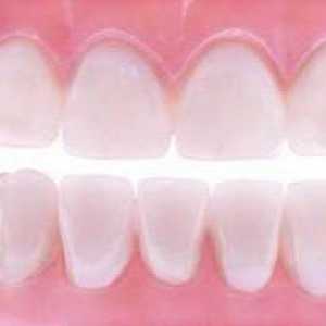 Zubne mekane proteze: stručne recenzije, fotografije
